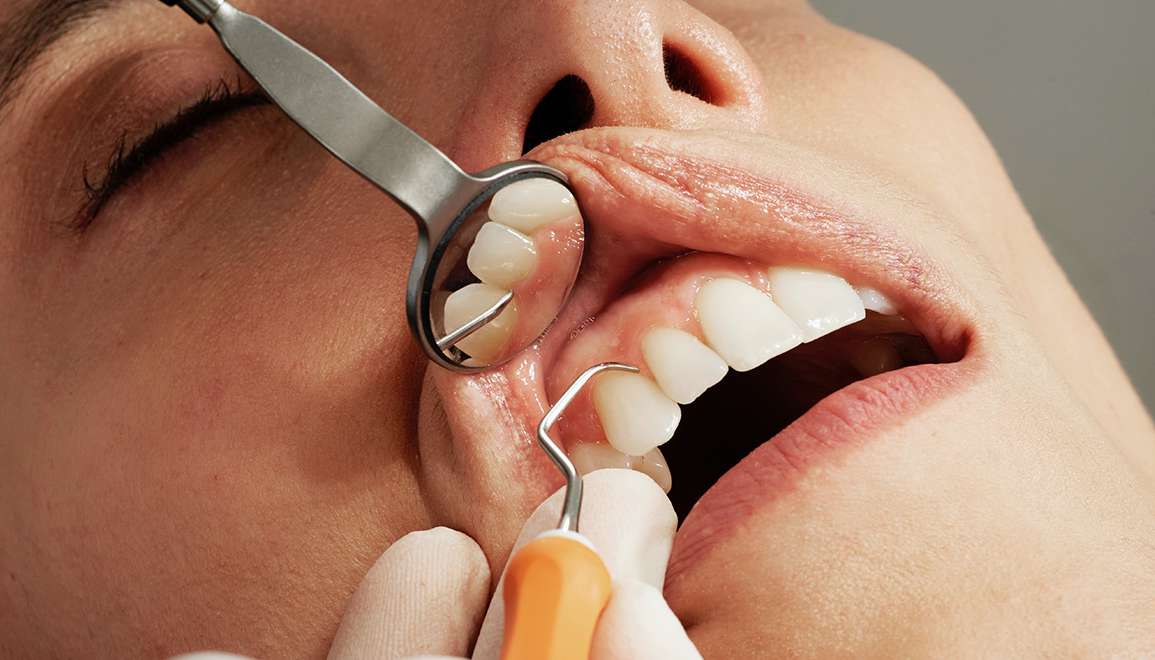 Periodontal Treatment