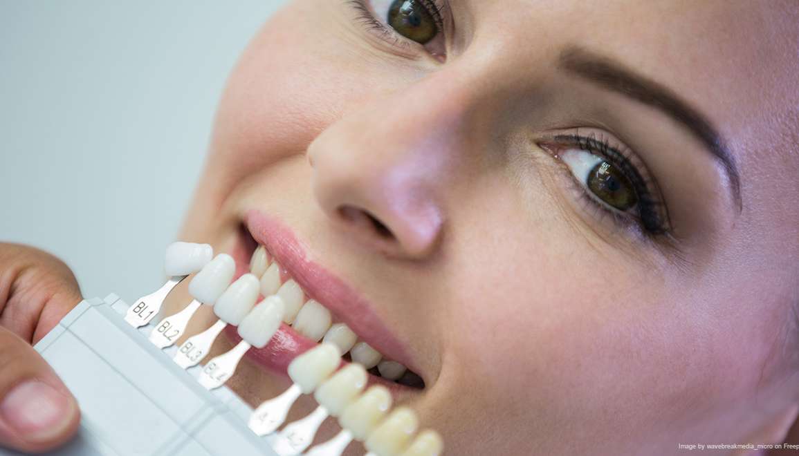 Tooth Replacement