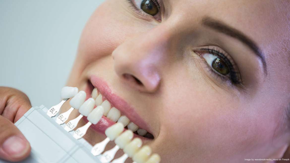 Tooth Replacement