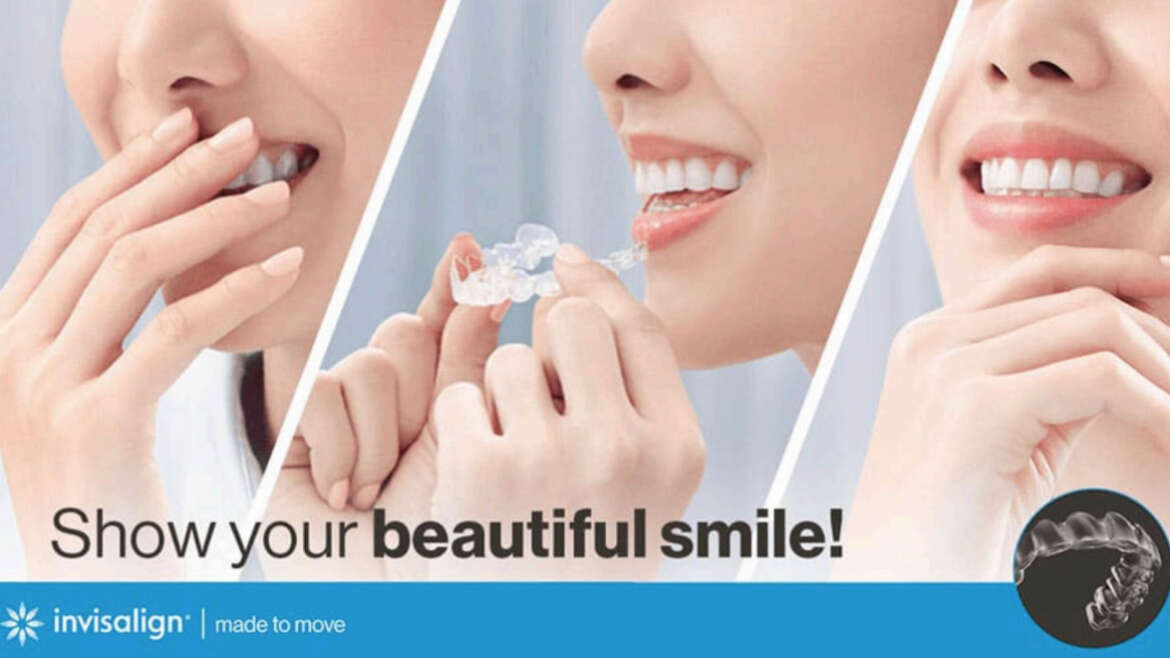Orthodontic Treatment