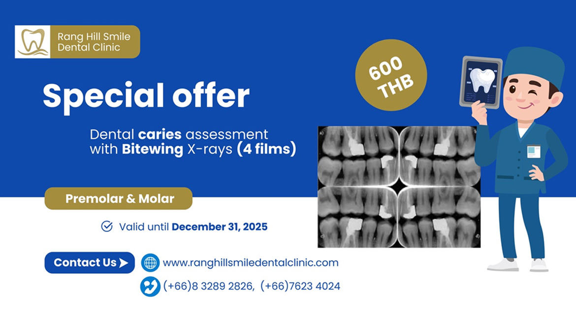 Dental caries assessment with Bitewing X-Rays