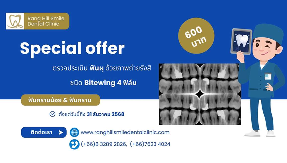 พิเศษ: ตรวจประเมินฟันผุ ด้วยภาพถ่ายรังสี ชนิด Bitewing 4 ฟิล์ม