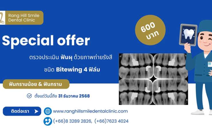 พิเศษ: ตรวจประเมินฟันผุ ด้วยภาพถ่ายรังสี ชนิด Bitewing 4 ฟิล์ม