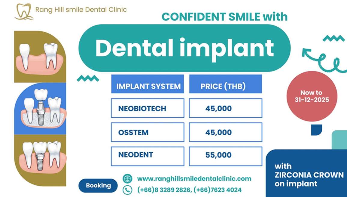 Dental Implant