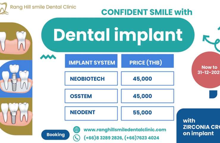 Dental Implant