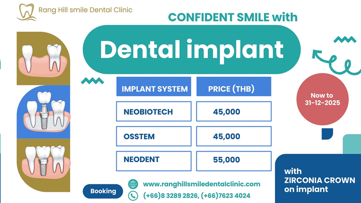 Dental Implant