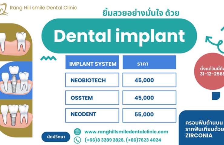 ยิ้มสวยอย่างมั่นใจด้วย Dental implant